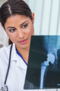 metal hip replacement lawsuit