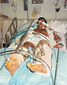 Steven Benvenisti after accident hospital