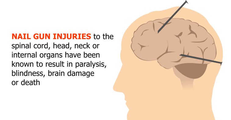 Nail gun injuries to the spinal cord, head, neck or internal organs have been known to result in paralysis, blindness, brain damage or death