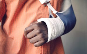 broken arm in cast
