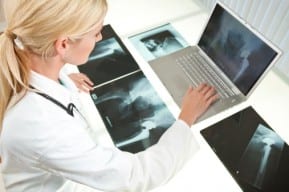 Doctor views xrays of side effects caused by different types of metal-on-metal hip implants