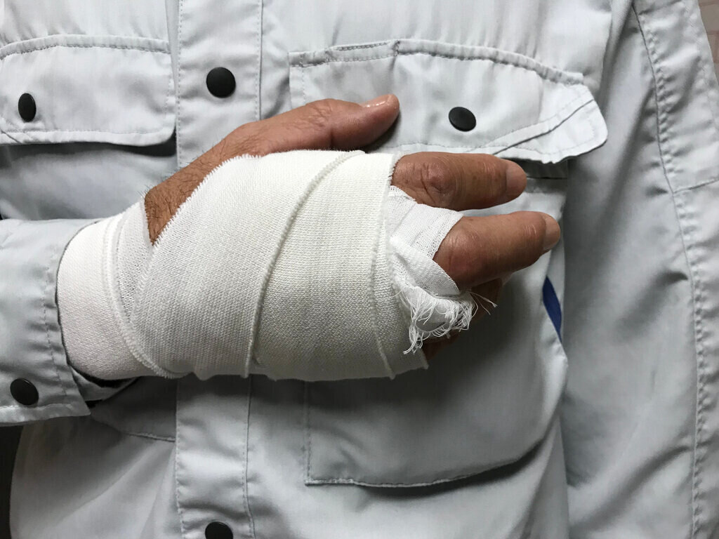 Work-related hand injury