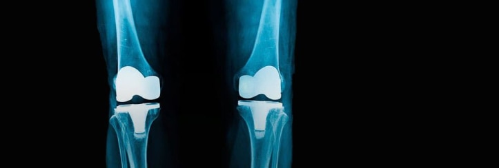 X-ray image